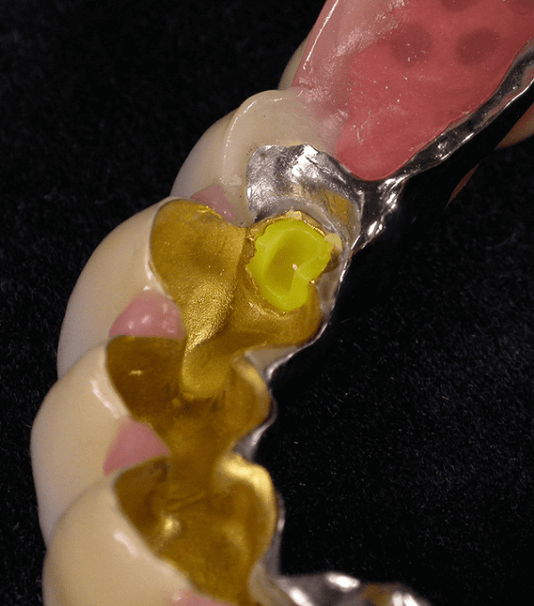 Galvanotechnik-Spezialist